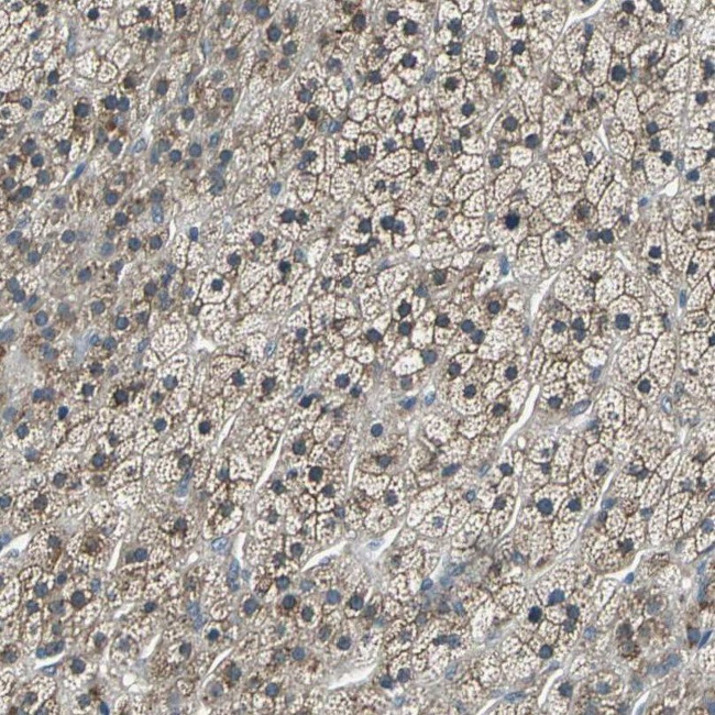 DIAPH1 Antibody in Immunohistochemistry (IHC)