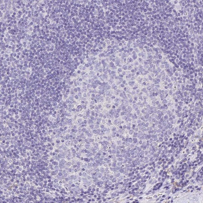 Annexin A10 Antibody in Immunohistochemistry (IHC)