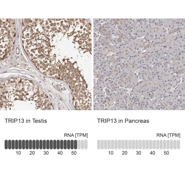 TRIP13 Antibody in Immunohistochemistry (IHC)