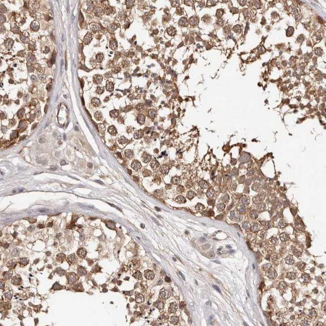 TRIP13 Antibody in Immunohistochemistry (IHC)