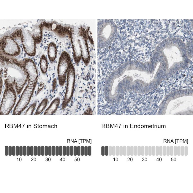 RBM47 Antibody in Immunohistochemistry (IHC)