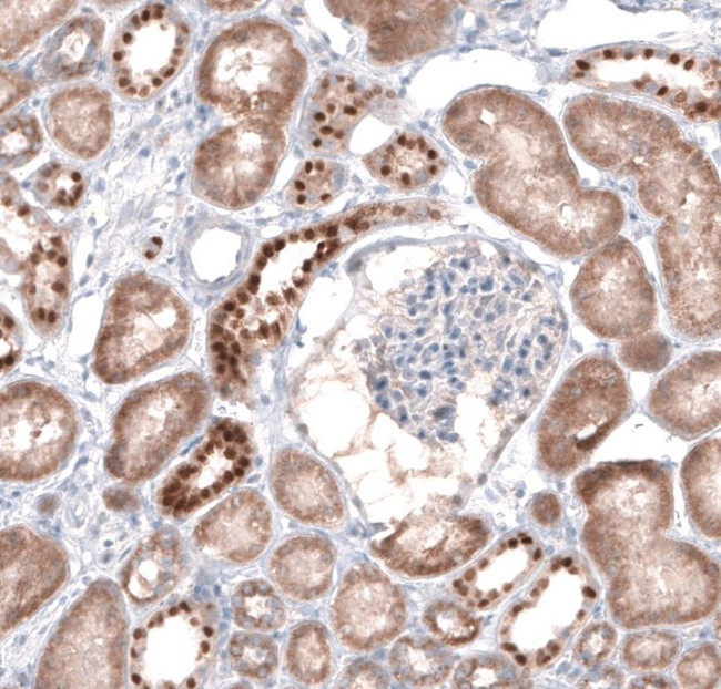 EMX1 Antibody in Immunohistochemistry (IHC)