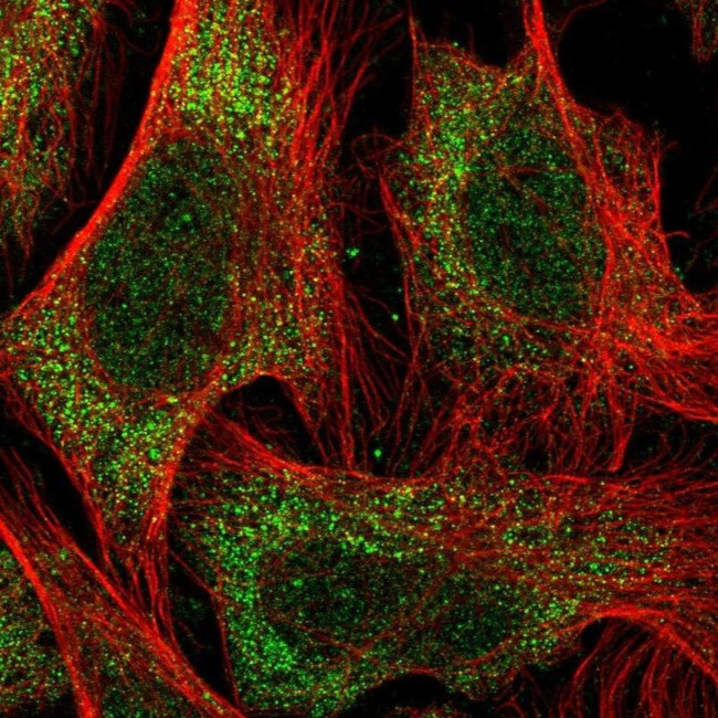 TBC1D9 Antibody in Immunocytochemistry (ICC/IF)