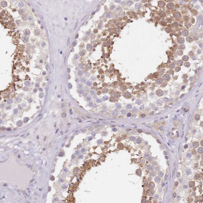 TBC1D9 Antibody in Immunohistochemistry (IHC)