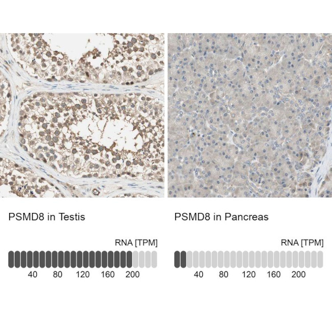 PSMD8 Antibody in Immunohistochemistry (IHC)