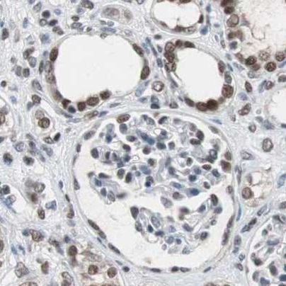 ZHX2 Antibody in Immunohistochemistry (IHC)