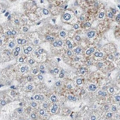 ZHX2 Antibody in Immunohistochemistry (IHC)