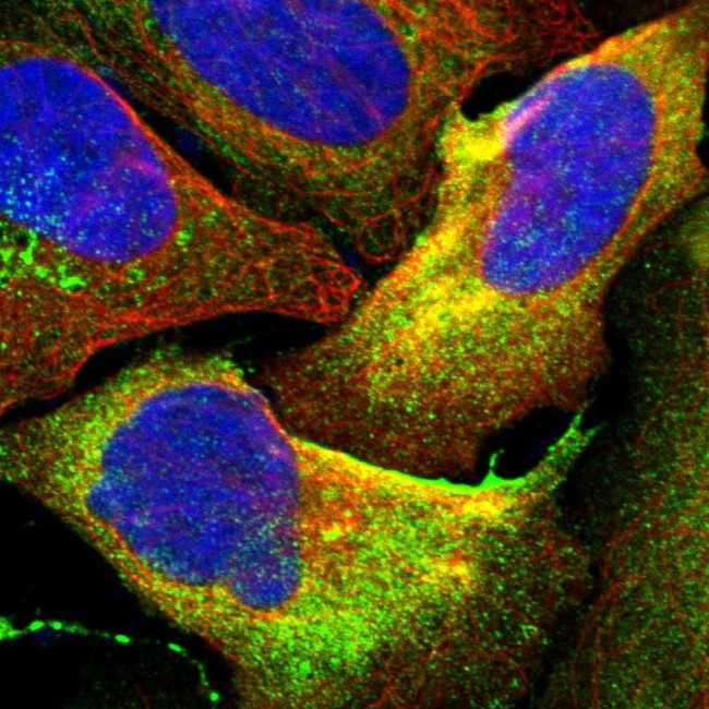 HAI-1 Antibody in Immunocytochemistry (ICC/IF)