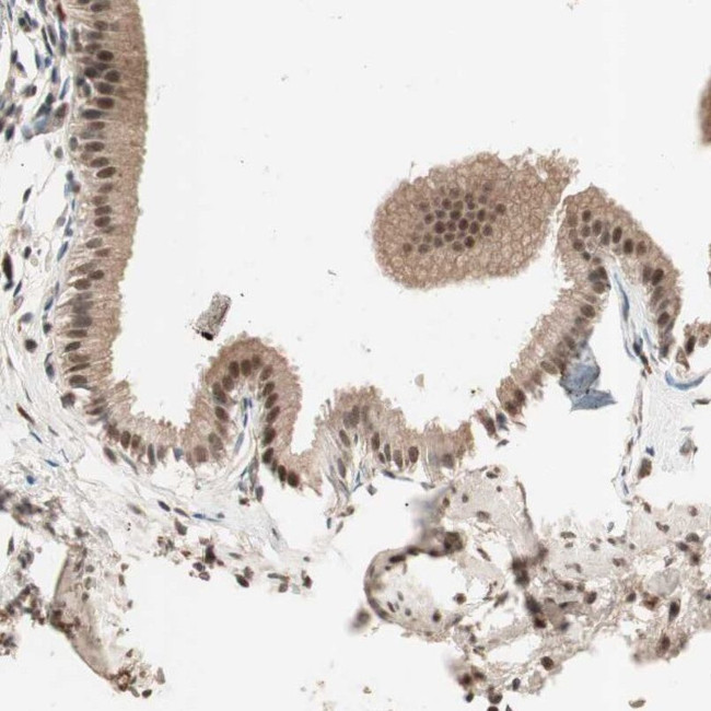 NFRKB Antibody in Immunohistochemistry (IHC)