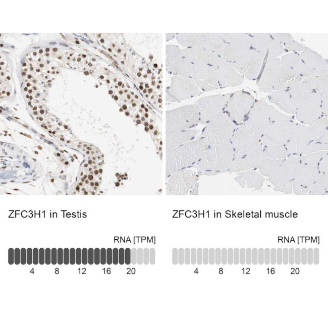 ZFC3H1 Antibody in Immunohistochemistry (IHC)