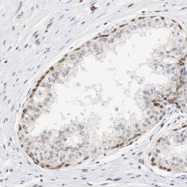 ZFC3H1 Antibody in Immunohistochemistry (IHC)