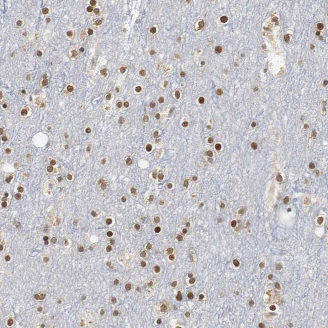 ZFC3H1 Antibody in Immunohistochemistry (IHC)