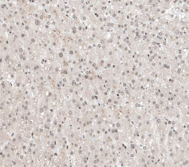 ALKBH5 Antibody in Immunohistochemistry (IHC)