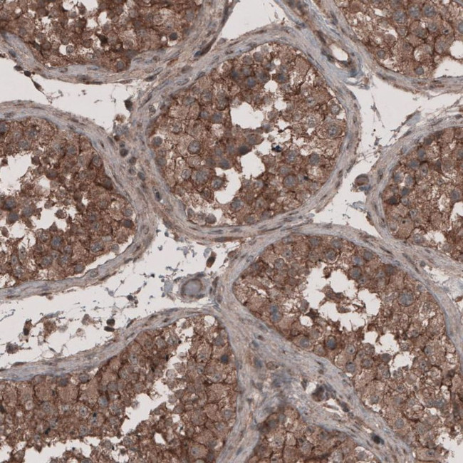 LSR Antibody in Immunohistochemistry (IHC)