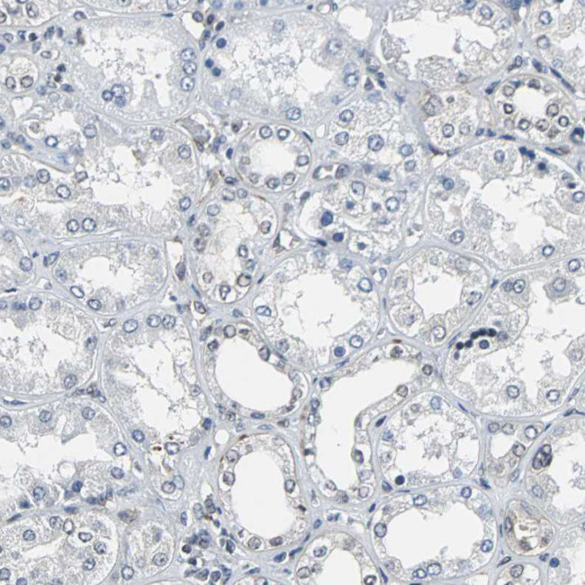 LSR Antibody in Immunohistochemistry (IHC)