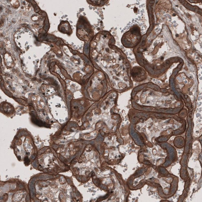 LSR Antibody in Immunohistochemistry (IHC)