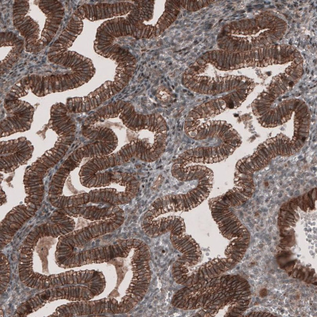 LSR Antibody in Immunohistochemistry (IHC)