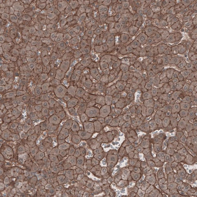 LSR Antibody in Immunohistochemistry (IHC)