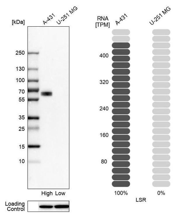 LSR Antibody in Western Blot (WB)