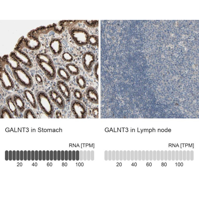GALNT3 Antibody in Immunohistochemistry (IHC)