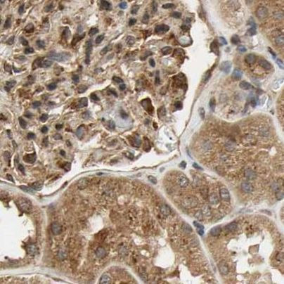 MRPS22 Antibody in Immunohistochemistry (IHC)