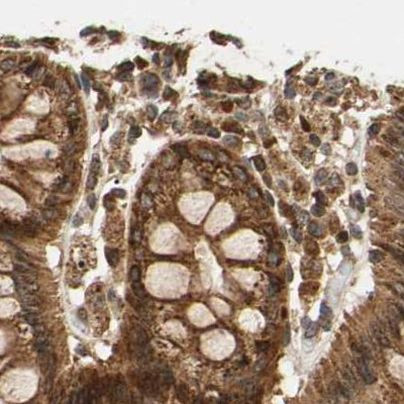 MRPS22 Antibody in Immunohistochemistry (IHC)