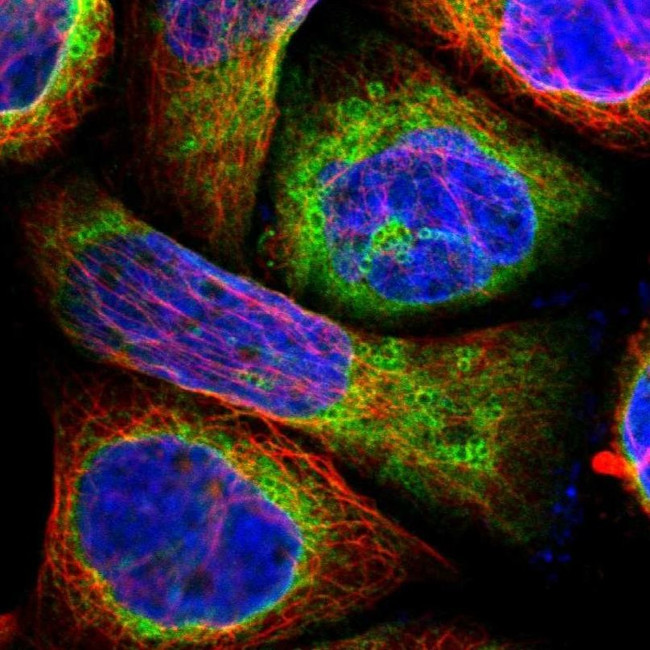 LPCAT2 Antibody in Immunocytochemistry (ICC/IF)