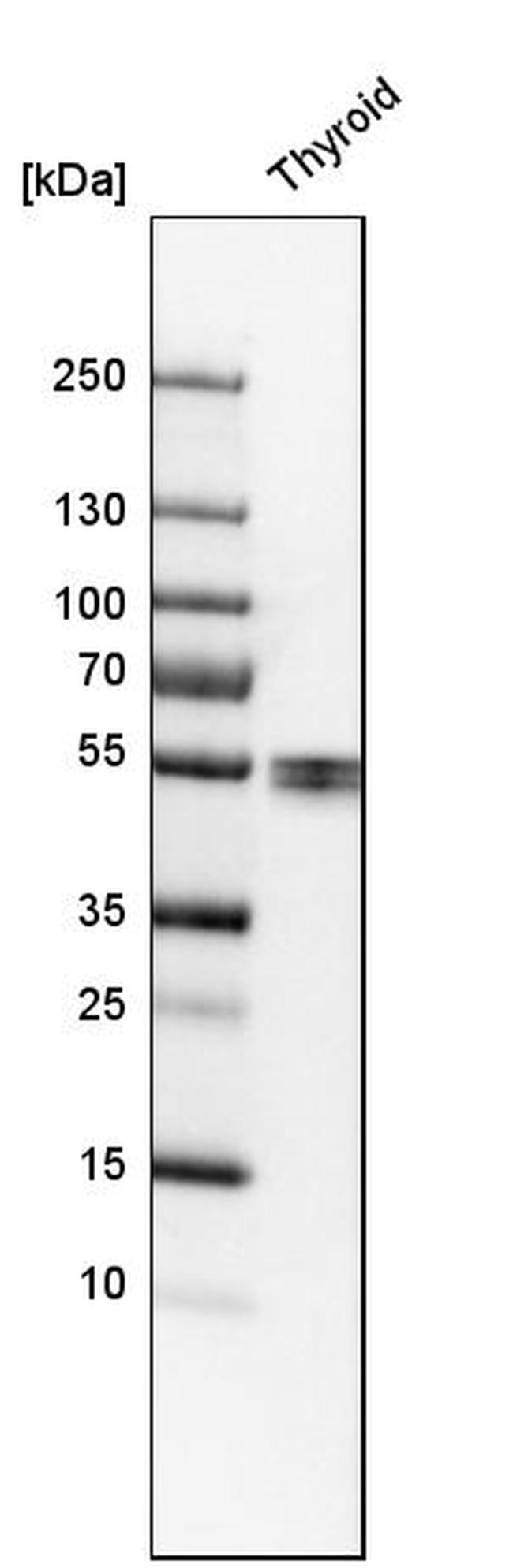 LPCAT2 Antibody in Western Blot (WB)