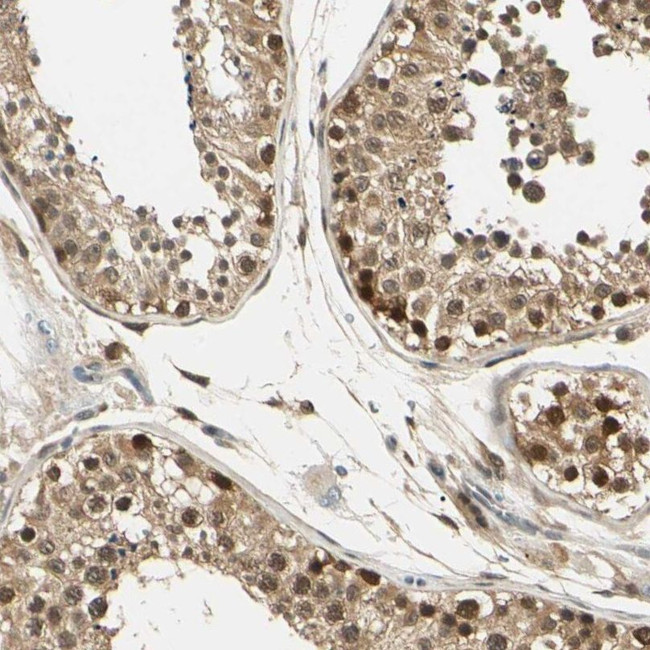 UBE2Z Antibody in Immunohistochemistry (IHC)