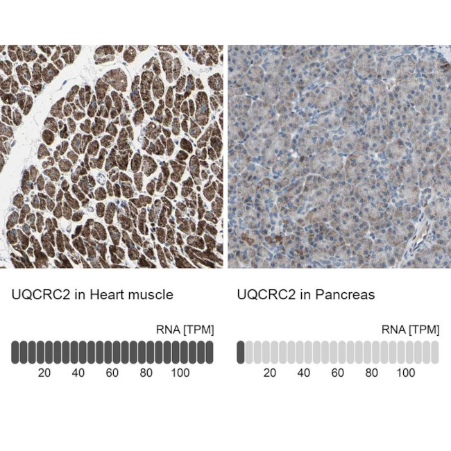 UQCRC2 Antibody in Immunohistochemistry (IHC)