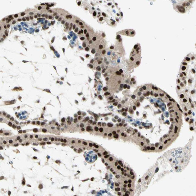 RNF43 Antibody in Immunohistochemistry (IHC)