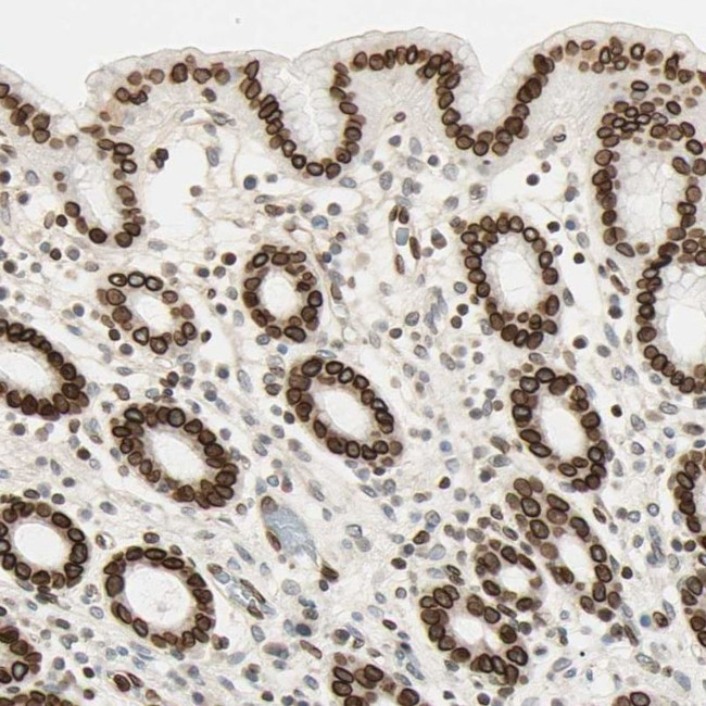 LAP2 Antibody in Immunohistochemistry (IHC)