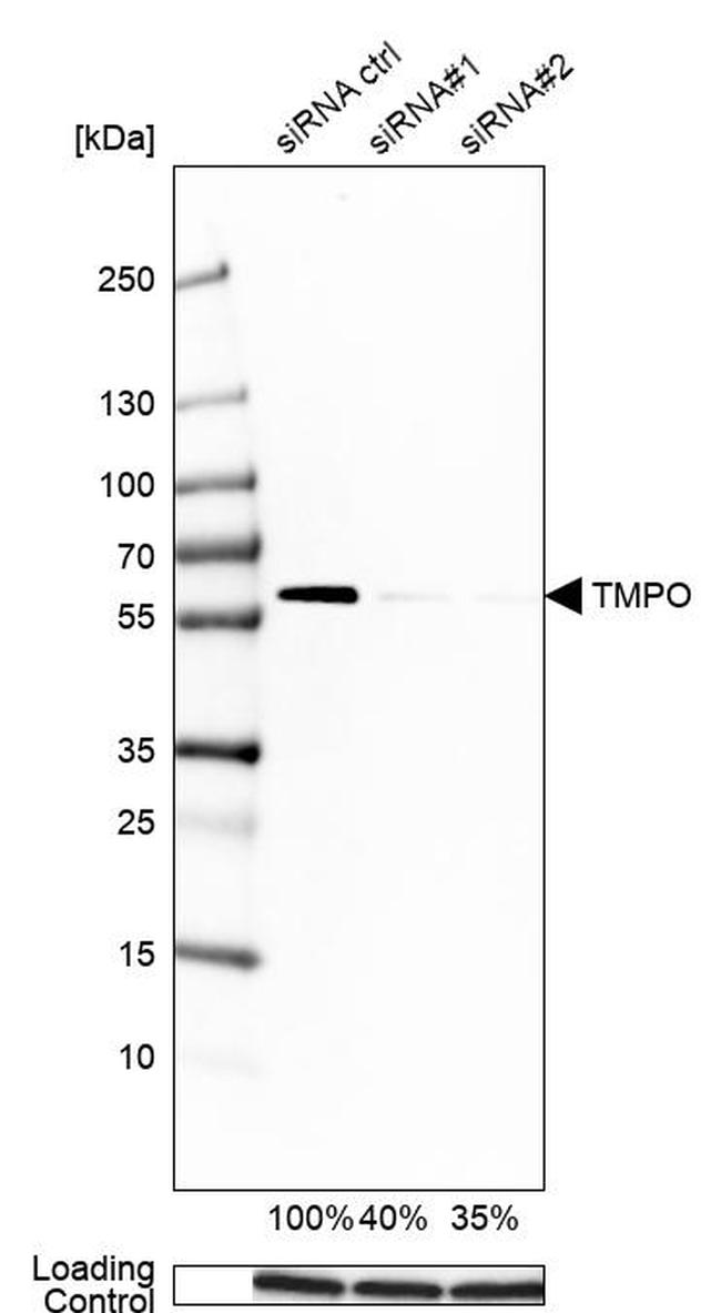 LAP2 Polyclonal Antibody (PA5-52519)