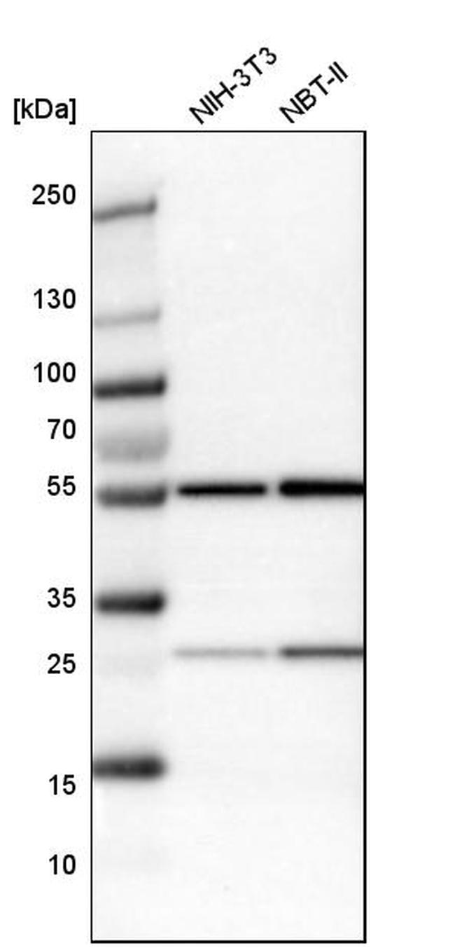 LAP2 Antibody in Western Blot (WB)