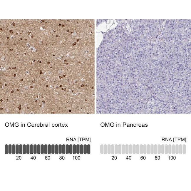 OMG Antibody in Immunohistochemistry (IHC)