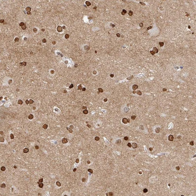 OMG Antibody in Immunohistochemistry (IHC)