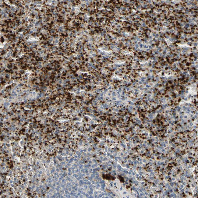 PPBP Antibody in Immunohistochemistry (IHC)