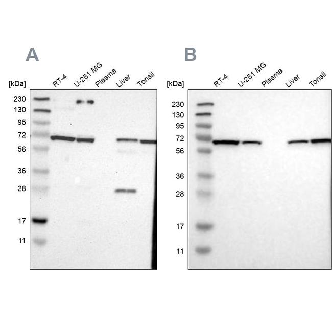 LTA4H Antibody in Western Blot (WB)