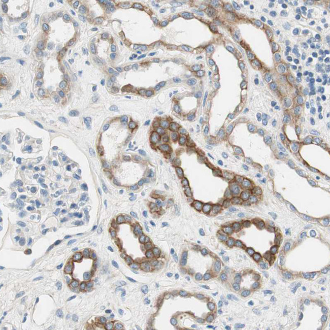 SLC22A2 Antibody in Immunohistochemistry (IHC)