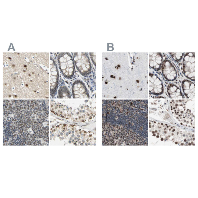 POGZ Antibody in Immunohistochemistry (IHC)