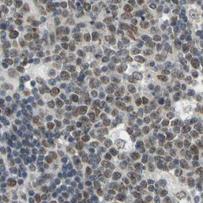 POGZ Antibody in Immunohistochemistry (IHC)