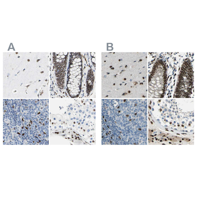 NFIA Antibody in Immunohistochemistry (IHC)