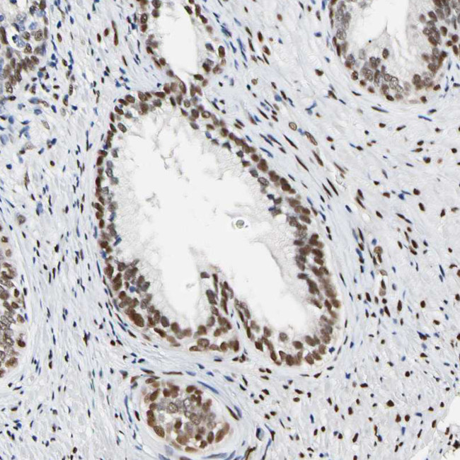 NFIA Antibody in Immunohistochemistry (IHC)