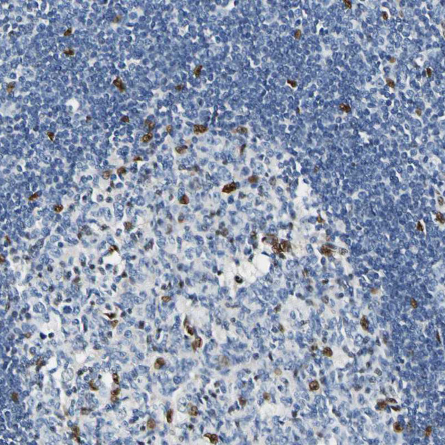 NFIA Antibody in Immunohistochemistry (IHC)