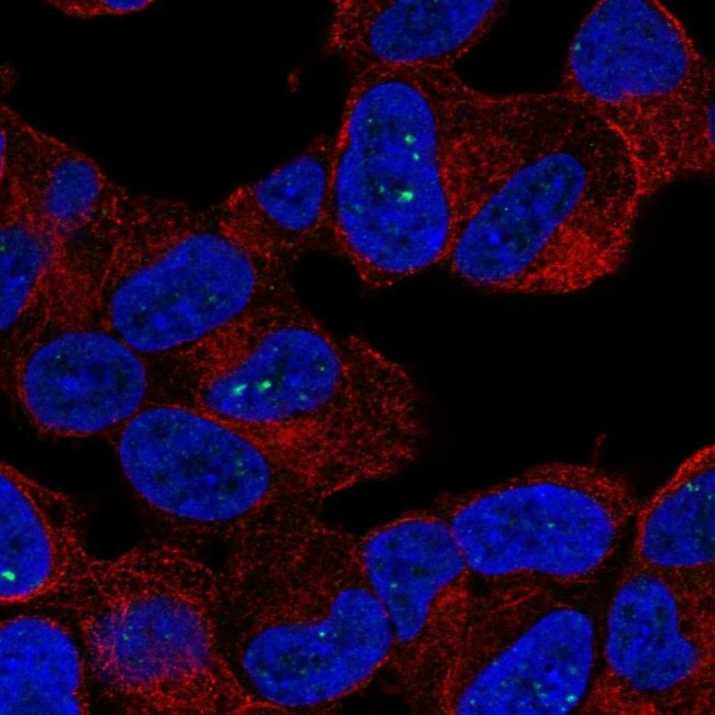 SLC27A6 Antibody in Immunocytochemistry (ICC/IF)