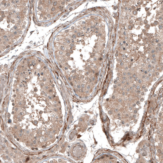 COL12A1 Antibody in Immunohistochemistry (IHC)