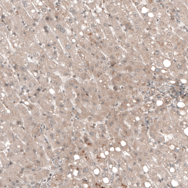 COL12A1 Antibody in Immunohistochemistry (IHC)