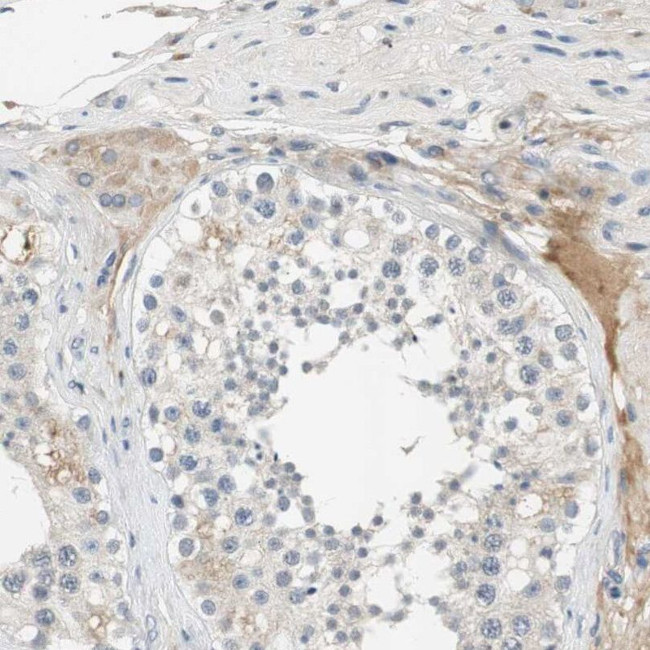 COL12A1 Antibody in Immunohistochemistry (IHC)