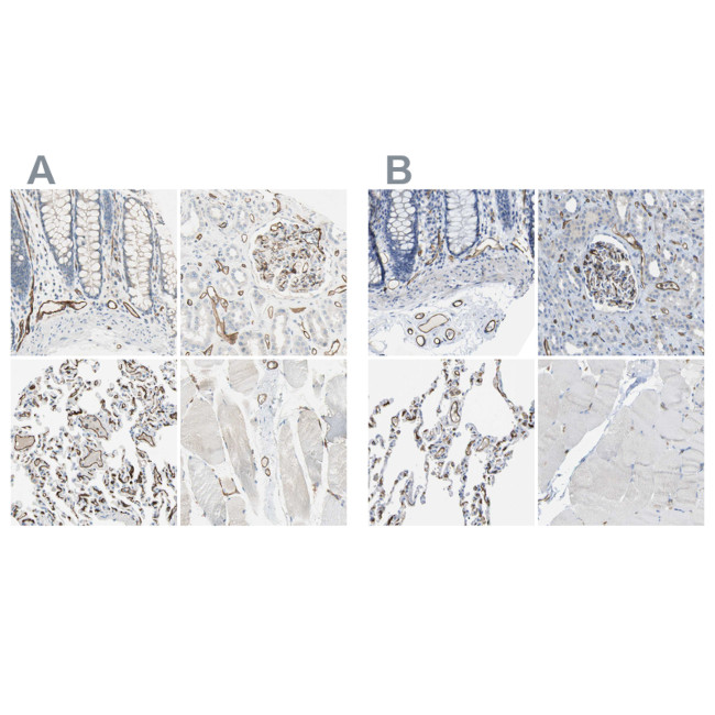 CD93 Antibody in Immunohistochemistry (IHC)