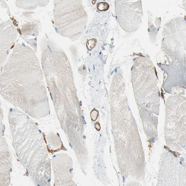 CD93 Antibody in Immunohistochemistry (IHC)